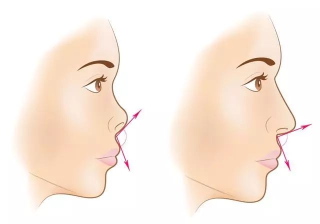 不用动刀鼻子变挺方法,不用修容怎么修鼻子小窍门