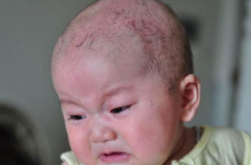 婴儿10个月剃头发技巧,宝宝满月剃头怎么讲究