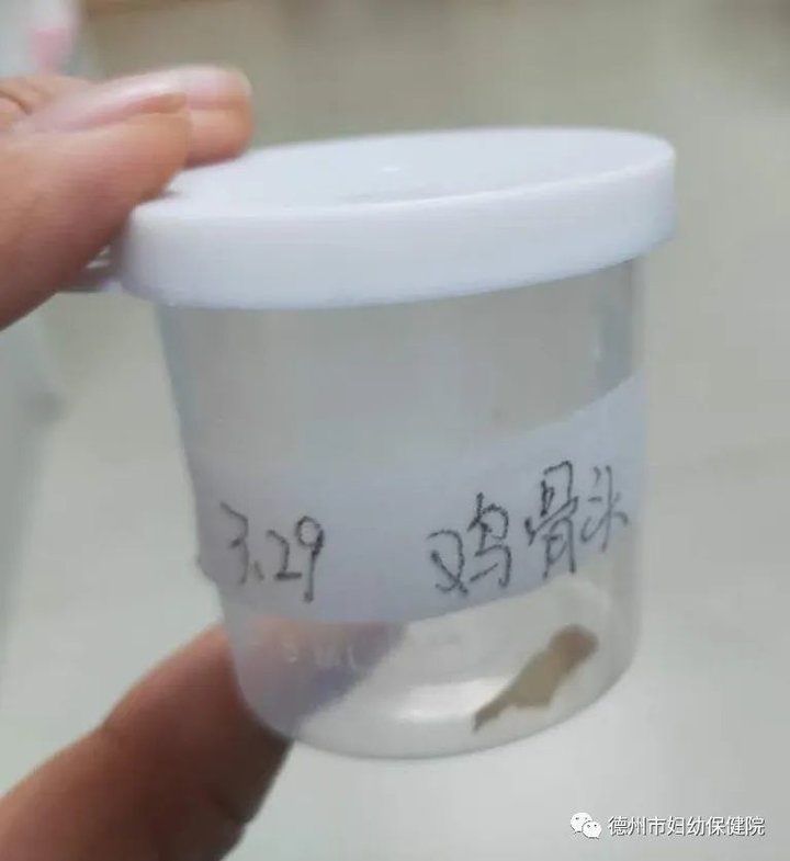 鸡骨头呛到鼻腔,鸡骨头卡在孩子喉咙