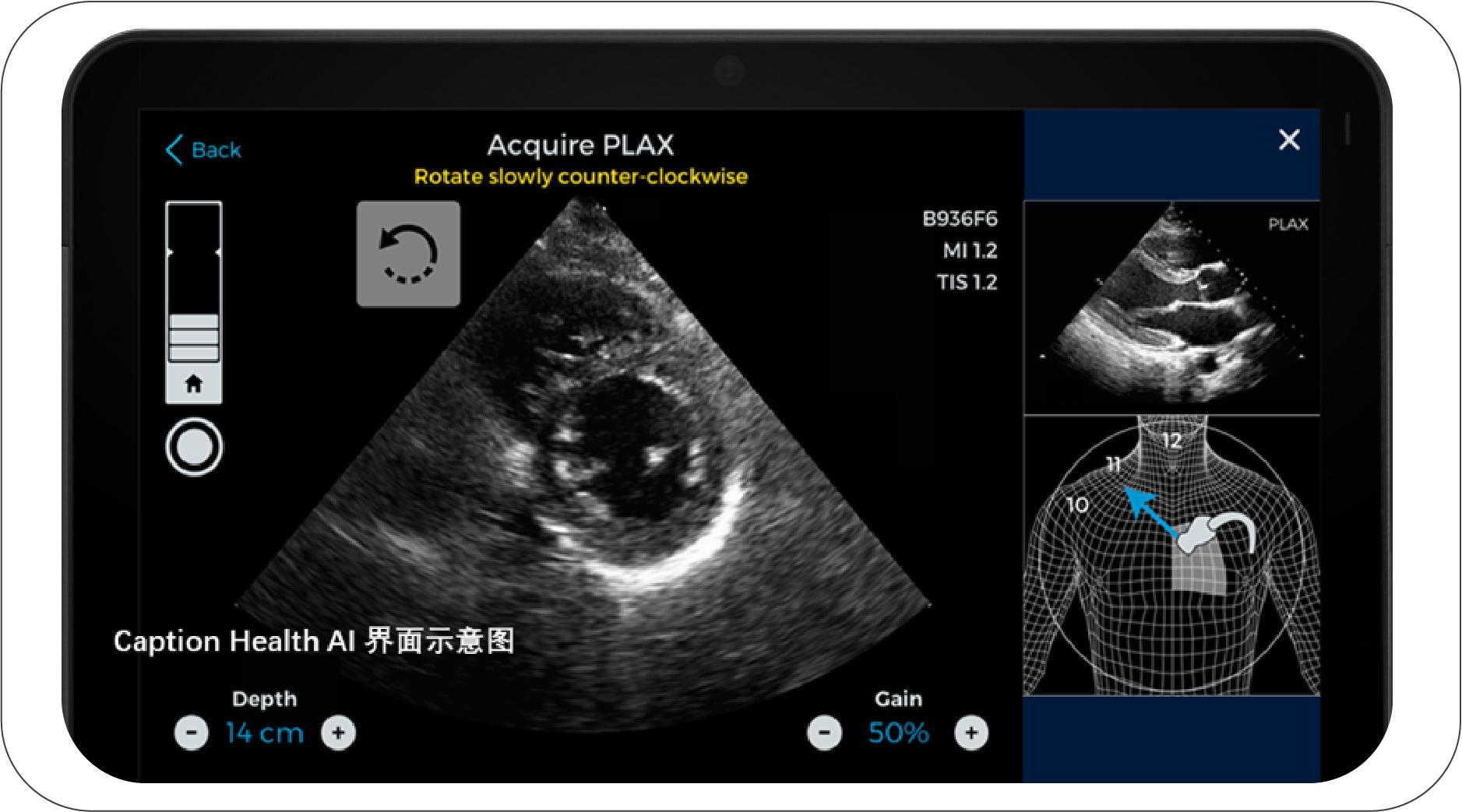 ai取代影像医生要多久,医学影像会被ai取代吗