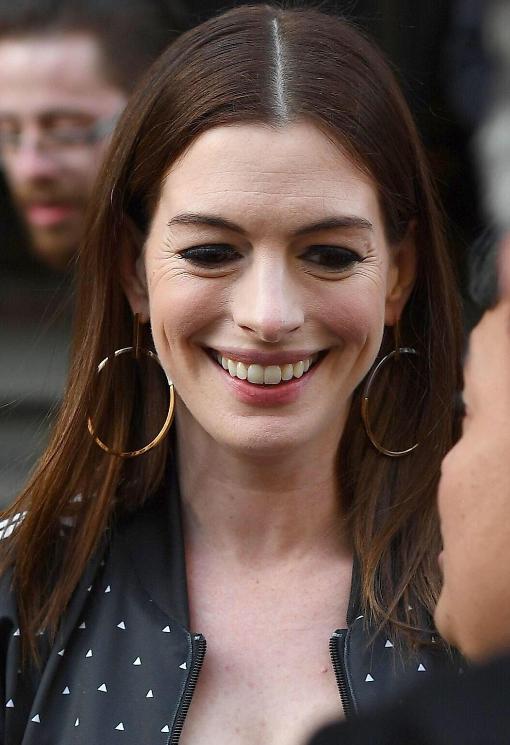 明星为何不除皱纹，热巴捧场纹好重，郑爽木偶纹完全不对称