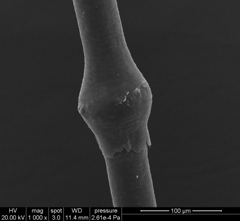 宝宝出生全身脱皮皮肤很红,出生半月的婴幼儿皮肤脱皮