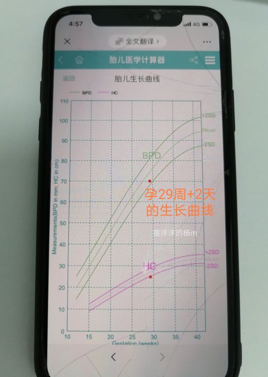 怀孕29周加6天胎儿偏小一周正常吗,孕37周宝宝4斤多正常吗