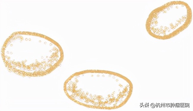 含草酸的菜焯水能去掉吗,哪些菜有草酸需要焯水