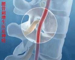 一文读懂靶向治疗,一文看懂椎体成形