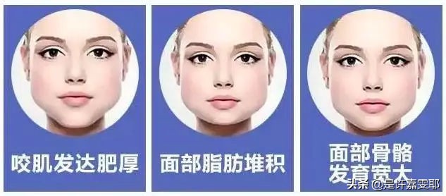 瘦脸针其实副作用挺大的吧,关于瘦脸的知识