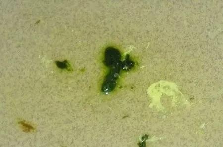 鸽子吐水是什么原因用什么药治,鸽子拉绿便吐水是什么原因