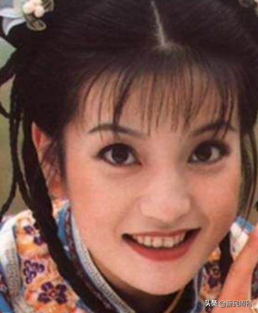 良医|明星们都在做烤瓷牙？但你最好别跟风