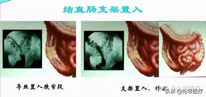 瑞金医院王忠敏,瑞金医院王忠敏简介