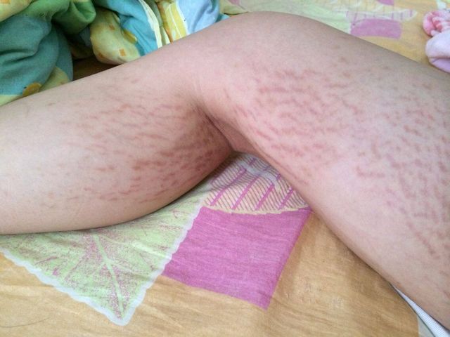 生娃前后对比女,生娃前后女人的变化