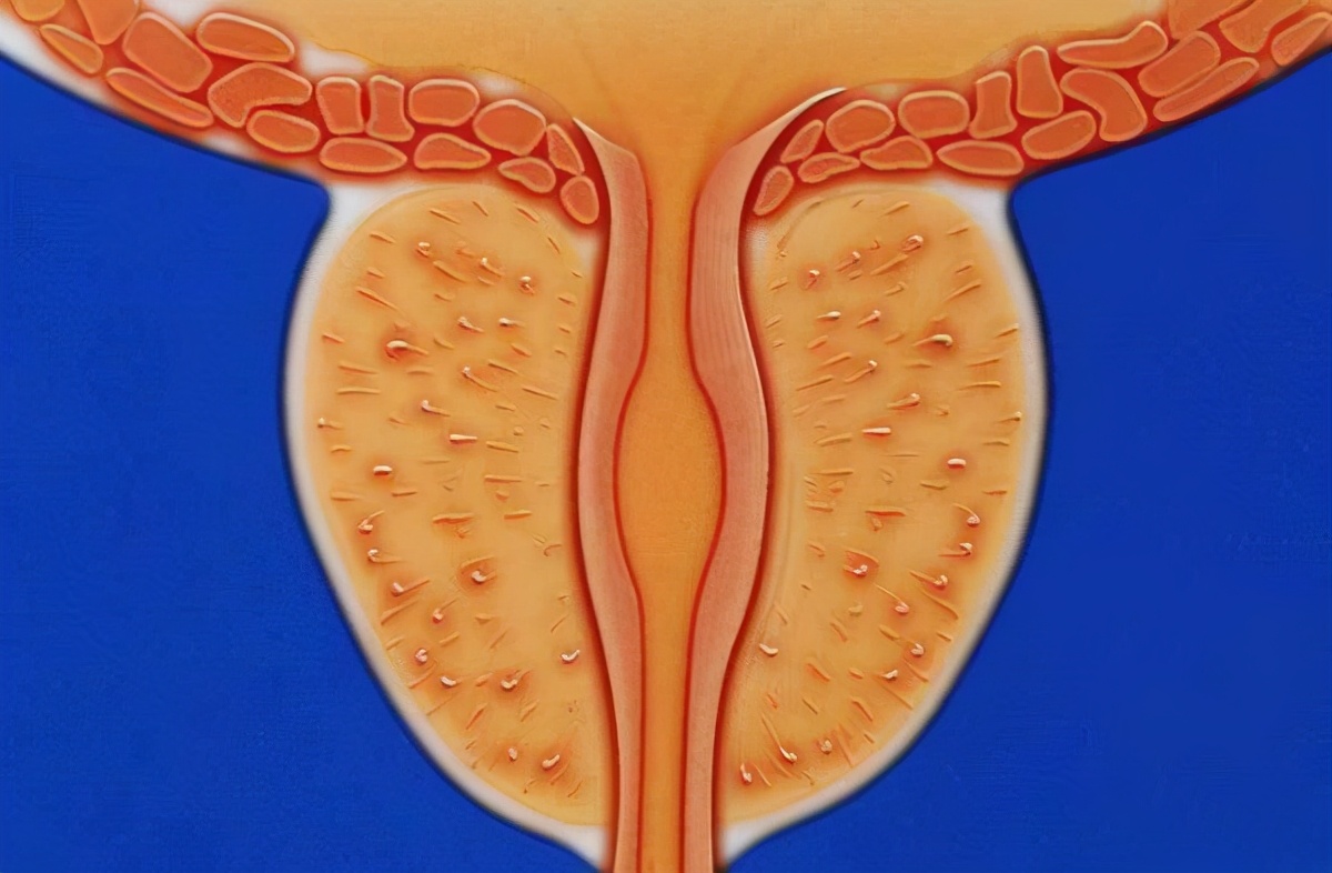 大学生沉迷蹦迪，和不同女生来往，前列腺炎入院，部分腺体被割掉