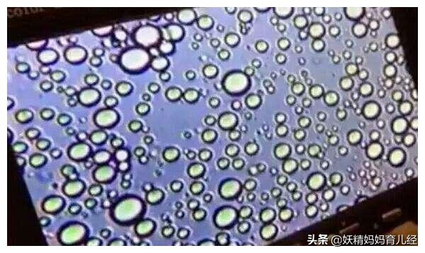 显微镜下母乳的力量有多大,母乳在显微镜下是什么