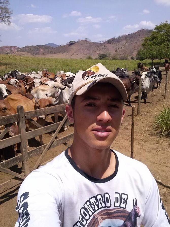 巴西医生太粗心给3岁男童割包皮出错将其生殖器割掉