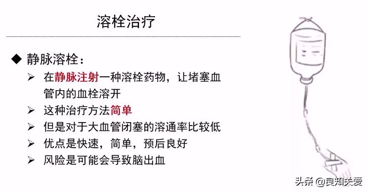 急性脑梗治疗需要多少钱,治疗急性脑梗输什么药