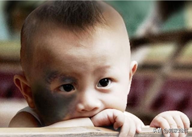 婴儿身上出现青斑图片,新生宝宝很黑的原因