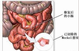 宝宝蛋白过敏为什么便血,宝宝便血的过敏源