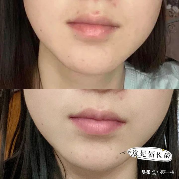 有哪些好用的祛痘印的产品,有哪些比较好的祛痘印产品