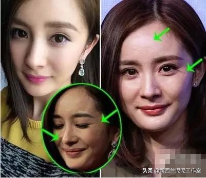 吴昕同款祛黄脸,吴昕眼袋