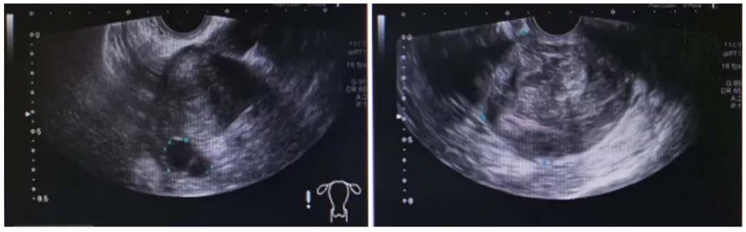 围绝经期综合征能治好吗,围绝经期综合征存在的护理问题有