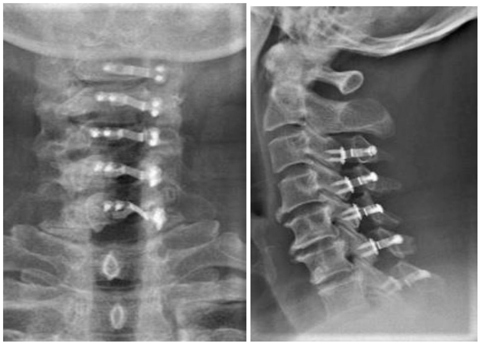 张忠根教授授课简介,李春根发改委