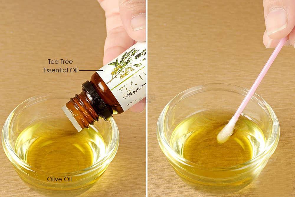 祛痘印不淡化黑色素,祛痘印长期不褪色