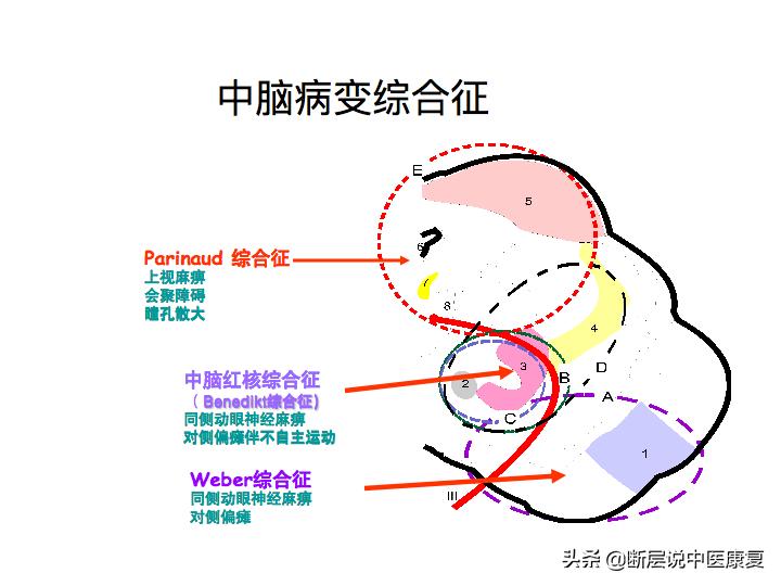 中枢神经系统断层解剖讲解,中枢神经3d解剖动画