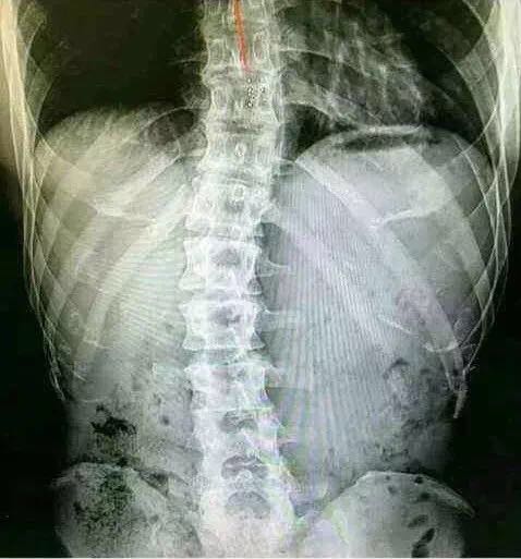 年度最健康聊天记录被疯传,*钟金**国:一个为活着而运动的男人....