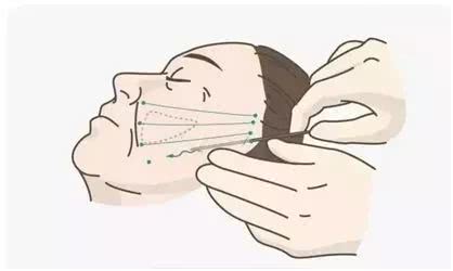 做了微整之后的感悟,微整经验