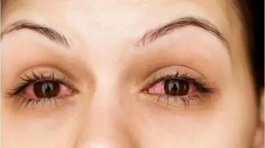 吸毒瞳孔的变化,吸毒和正常人瞳孔对比图