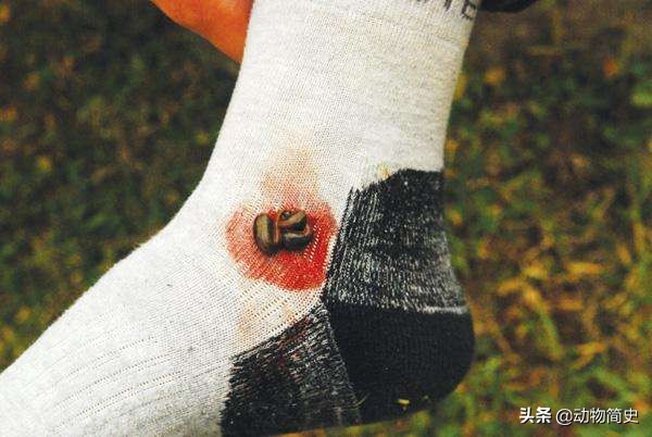 水蛭吸血救人视频,水蛭吸血疗法的正确方法