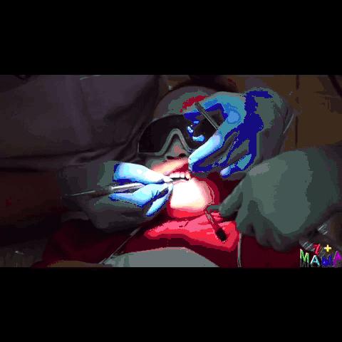 孩子牙菌斑怎么清除,孩子牙菌斑