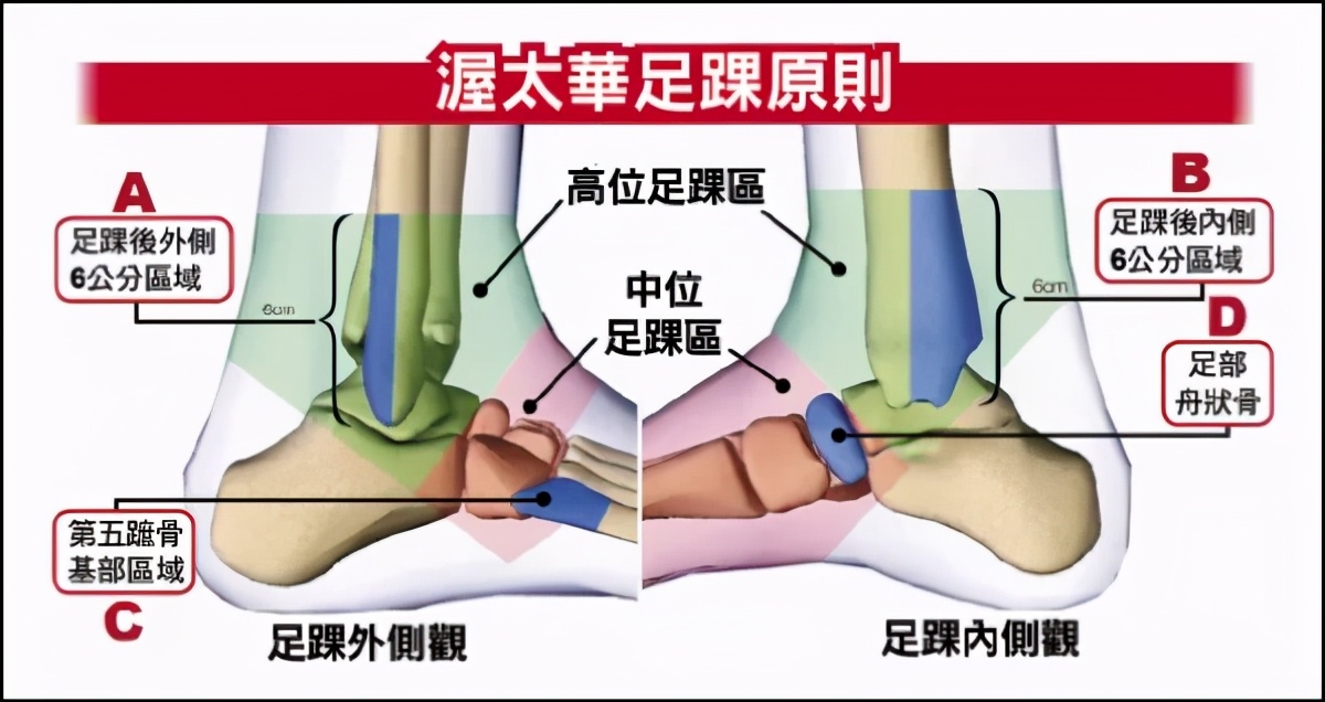 踝关节扭伤后绑护踝更痛了,踝关节扭伤用护踝要用多久