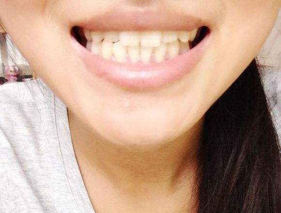 如何笑起来好看的技巧,如何笑出好看的笑容