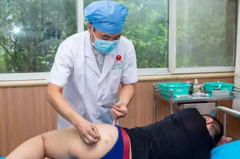 五虎擒羊是指什么穴位,五虎擒羊针法