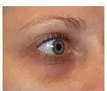 罗志祥的黑眼圈到底是怎么回事,罗志祥同款黑眼圈是什么意思