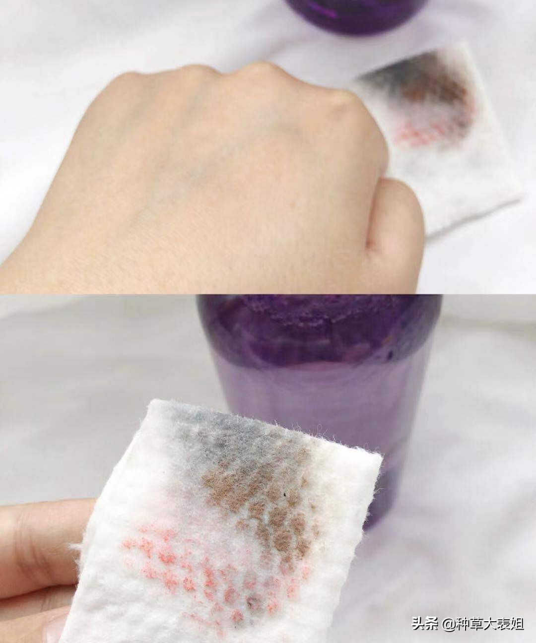 双十一必买水乳油痘肌,双11必买卸妆水