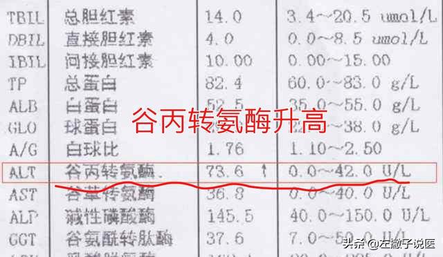 体检谷丙转氨酶高是怎么回事呢,体检发现谷丙转氨酶升高怎么办