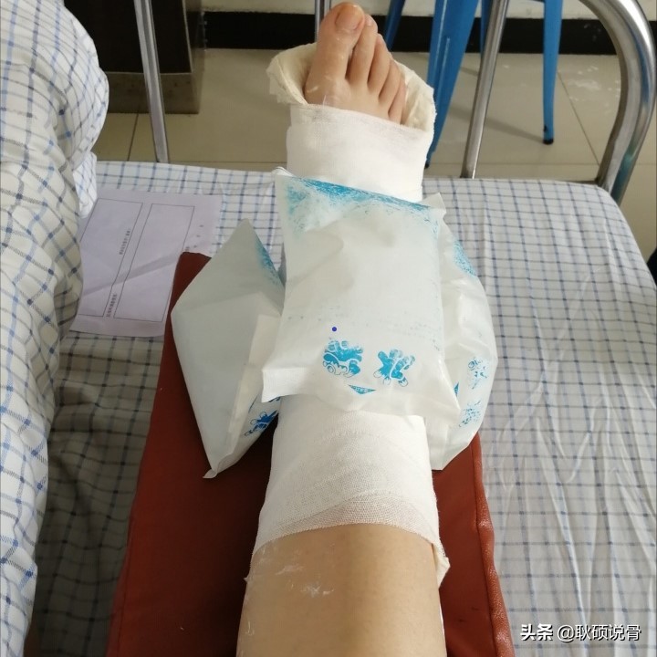 关节扭伤急救期处理原则,关节扭伤冰敷的正确方法