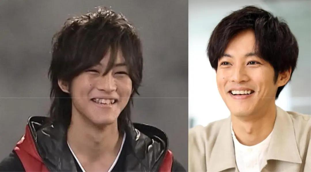 日本整牙的明星,日本整牙明星