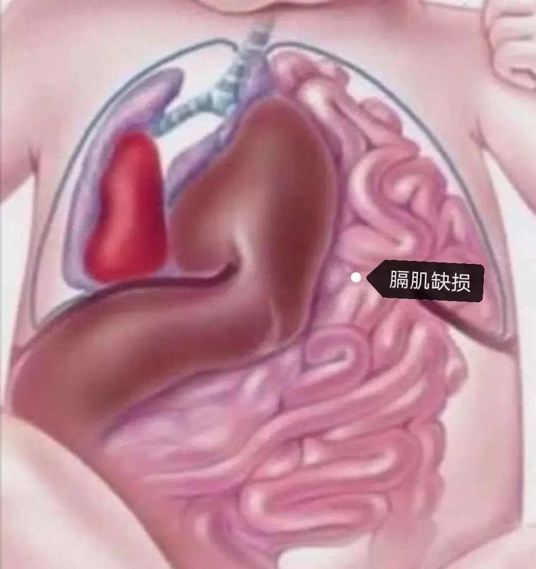 5岁儿童胃炎还胀气咕噜响怎么办,四岁孩子偶尔说胃和食管交界处疼