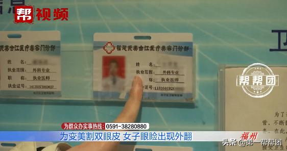 90后割双眼皮亲身经历,割了双眼皮后特后悔