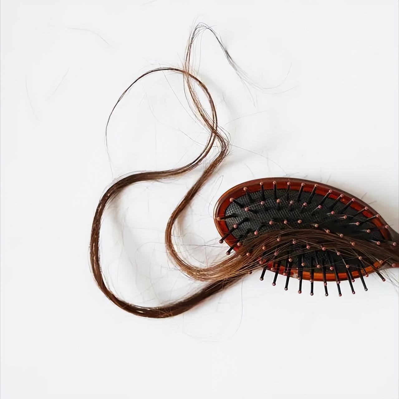 科普秃顶,减肥脱发快秃了怎么办