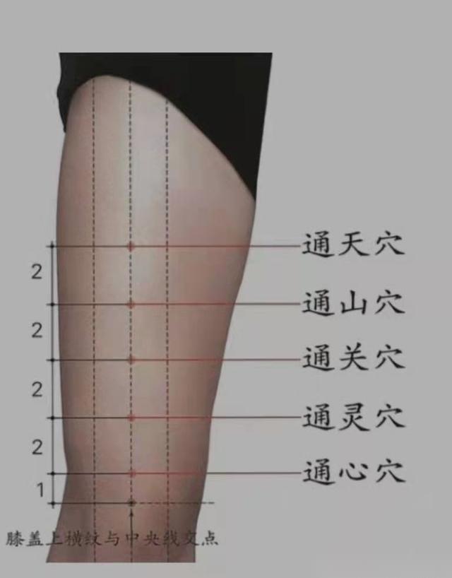 泌尿系疾病针灸,泌尿系统感染针灸哪里最有效