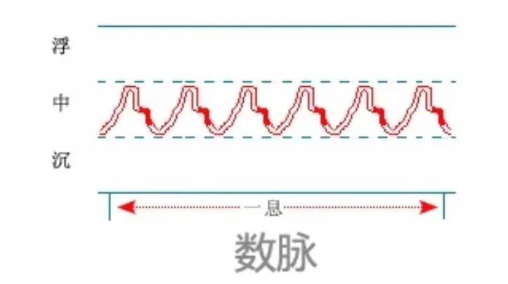 中医28脉诊歌诀及示意图,中医28脉全部脉象图解