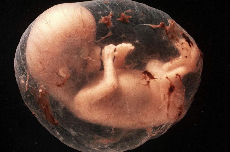 “阴阳人”真的存在？有女性器官也有男性器官？医生做出解释