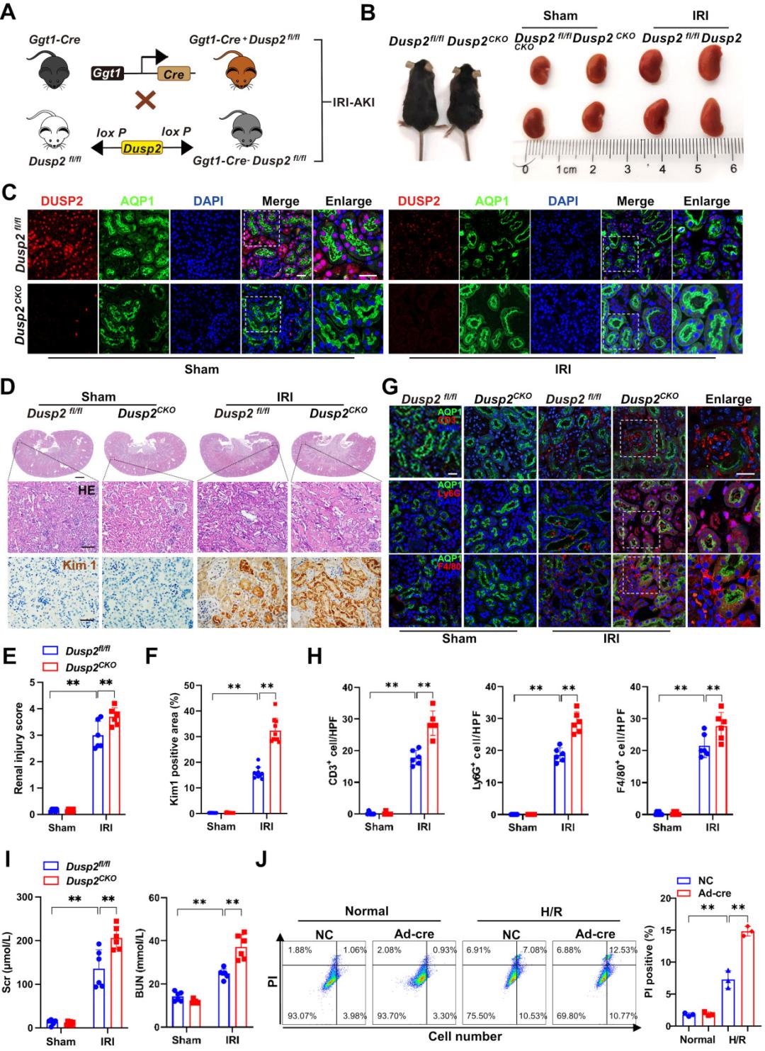 Theranostics|急性肾损伤治疗策略