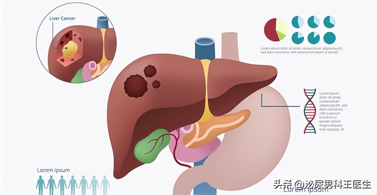 排尿很黄、异味很大？身体向你暗示的这3件事，可能与疾病有关
