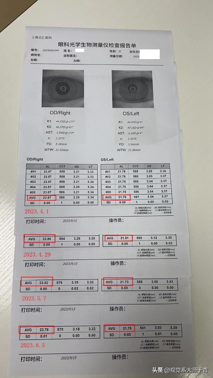 28岁近视散光加弱视怎么治疗,门诊故事汇