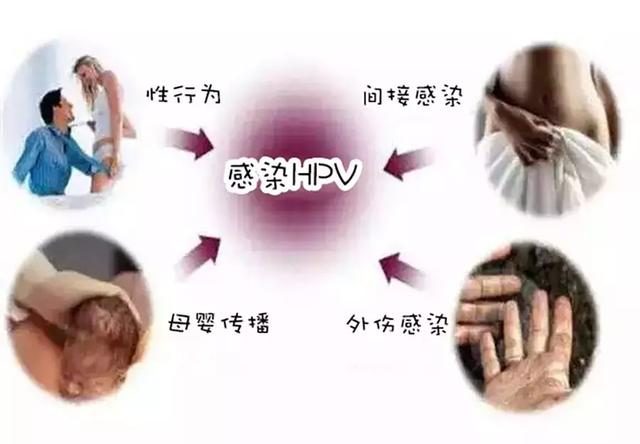 关于hpv你应该知道的事,关于hpv你必须知道的事