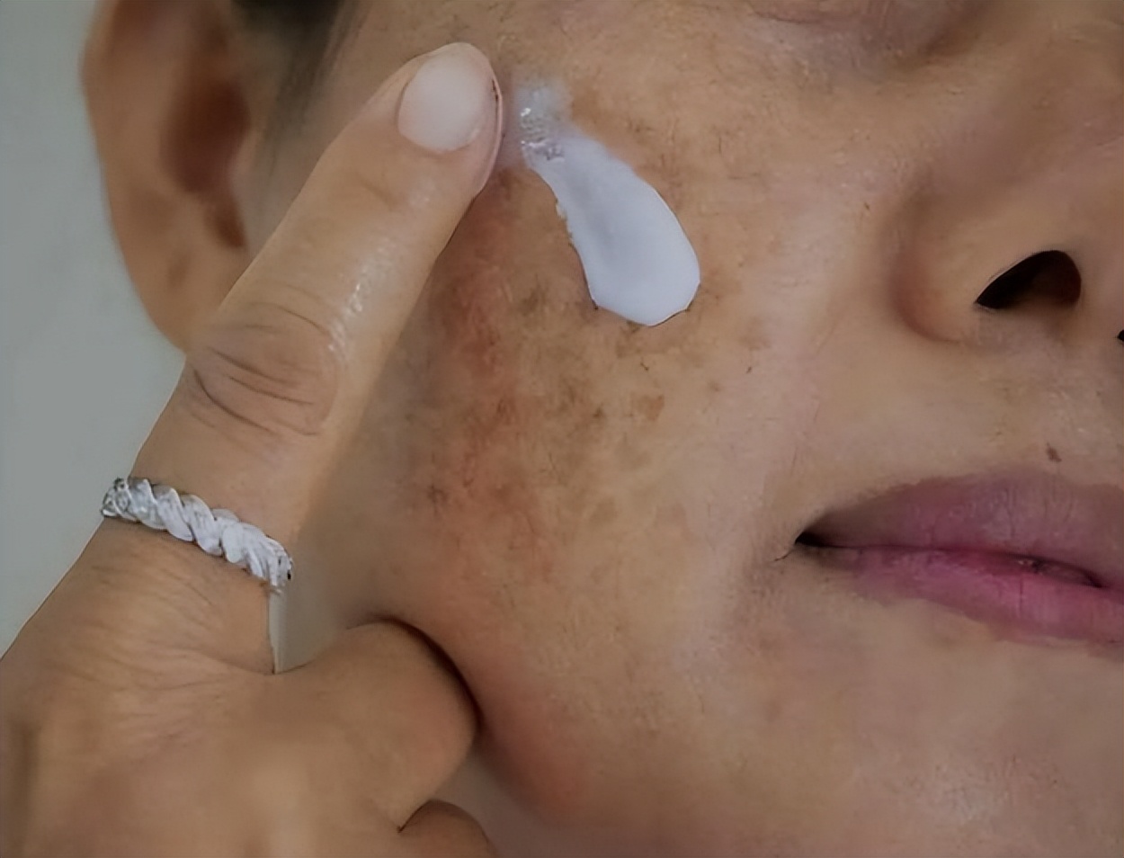 2块钱的红霉素软膏有淡斑效果吗,红霉素软膏的淡斑方法真实测评